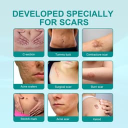 image-South Moon Scar Care Spray - Burn & Stretch Mark