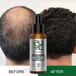 image-PURC Rosemary Hair Oil - Mint Ginger Scalp Treatment
