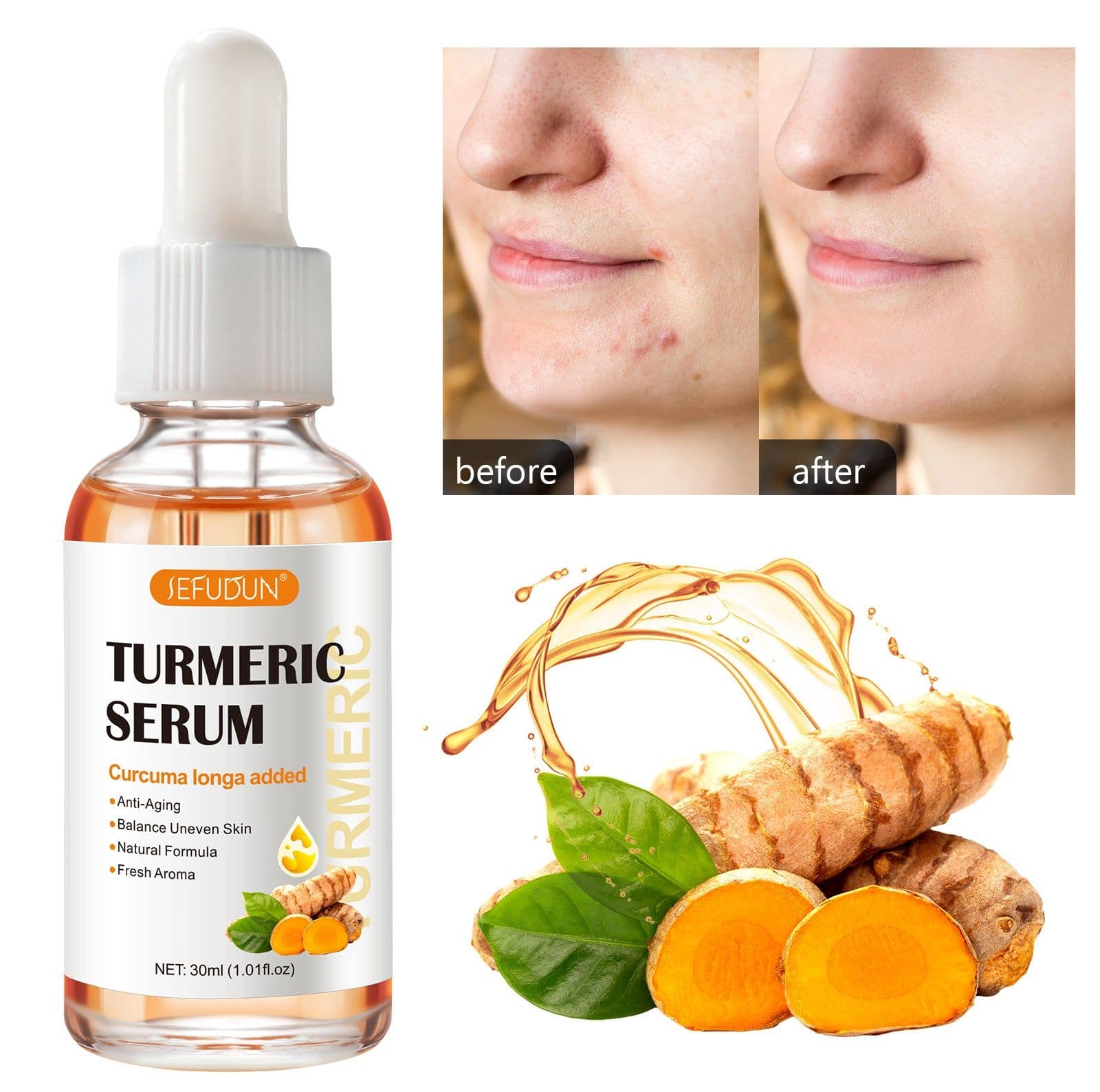 image-SEFUDUN Turmeric Essential Oil 30ml - Brightening
