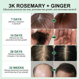 image-PURC Rosemary Hair Oil - Mint Ginger Scalp Treatment