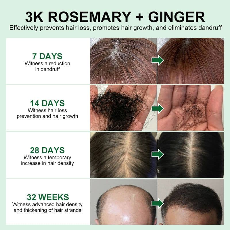 image-PURC Rosemary Hair Oil - Mint Ginger Scalp Treatment