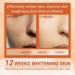 image-EELHOE Vitamin C Hydrating Facial Essence Spray 50ml