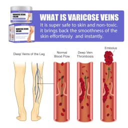 image-West&Month Vein Cream 30g Leg Pain Relief