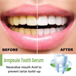 image-Teeth Whitening Essence - Stain Cleaning, Fresh Breath, Bright Teeth, 50ml