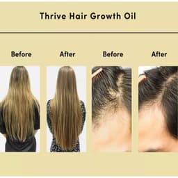 image-Cross-border exclusively for THRIVE GROWTH HAIR OIL to improve frizz nourishing hair care essential oil repair essential oil