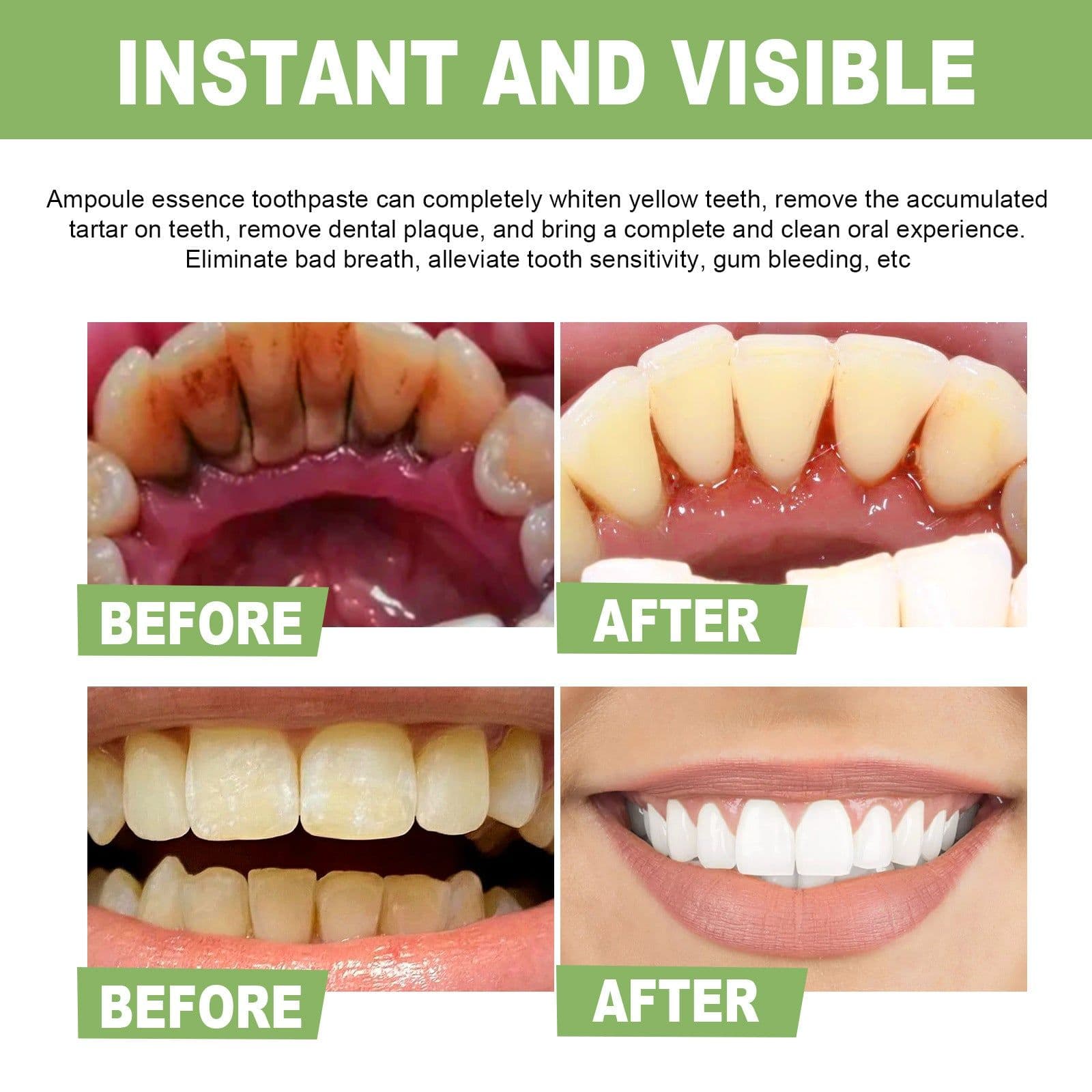 image-Teeth Whitening Essence - Stain Cleaning, Fresh Breath, Bright Teeth, 50ml