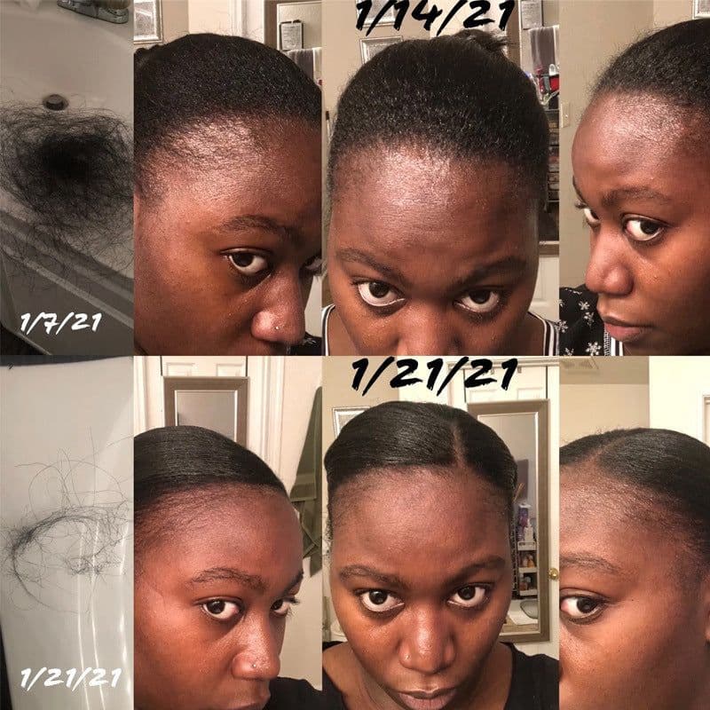 image-Hair Growth Oil - Hair Care Essential Oil