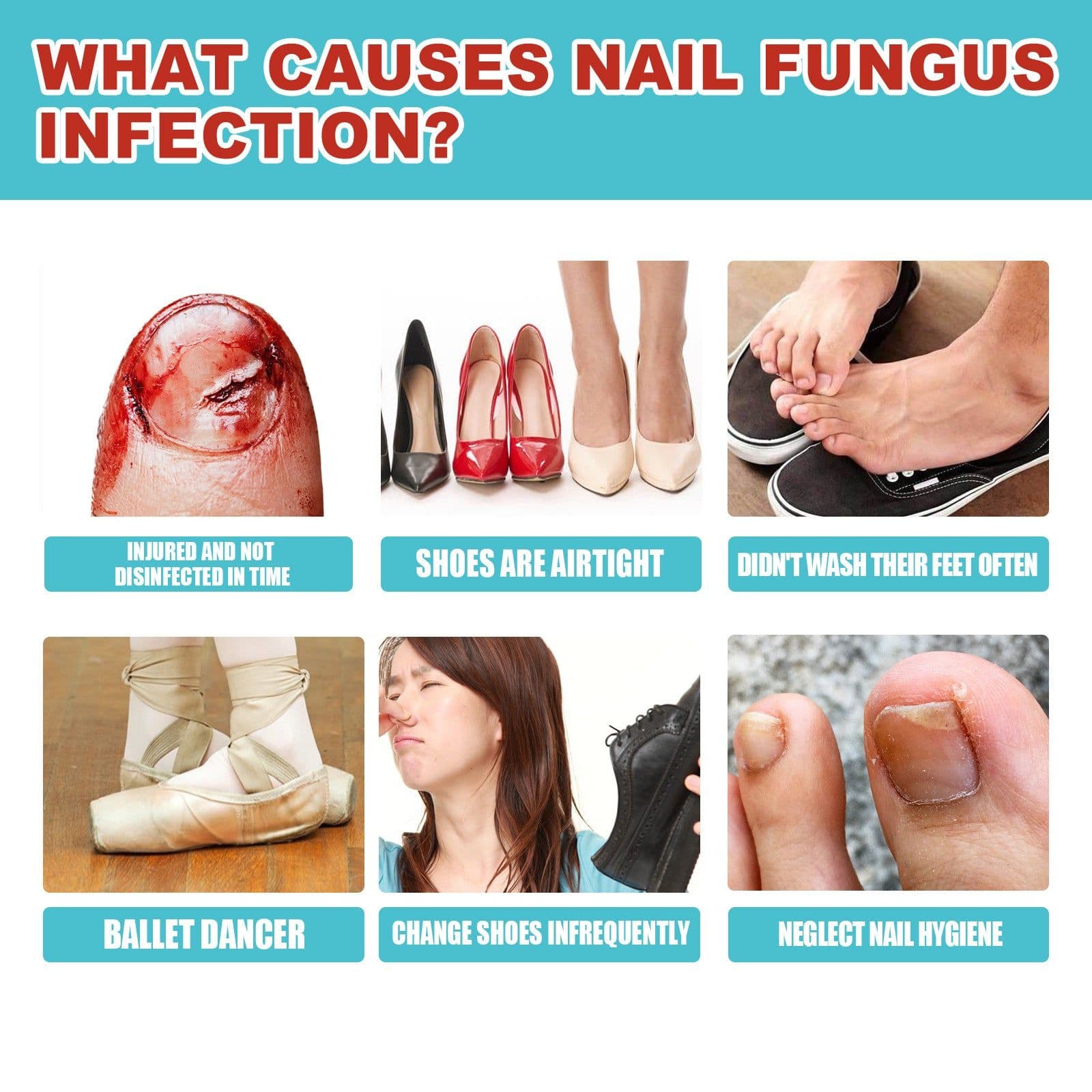 image-South Moon Nail Repair Patches Onychomycosis