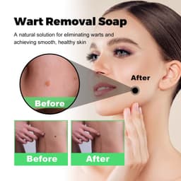 image-South Moon Anti-Wart Soap - Face & Body