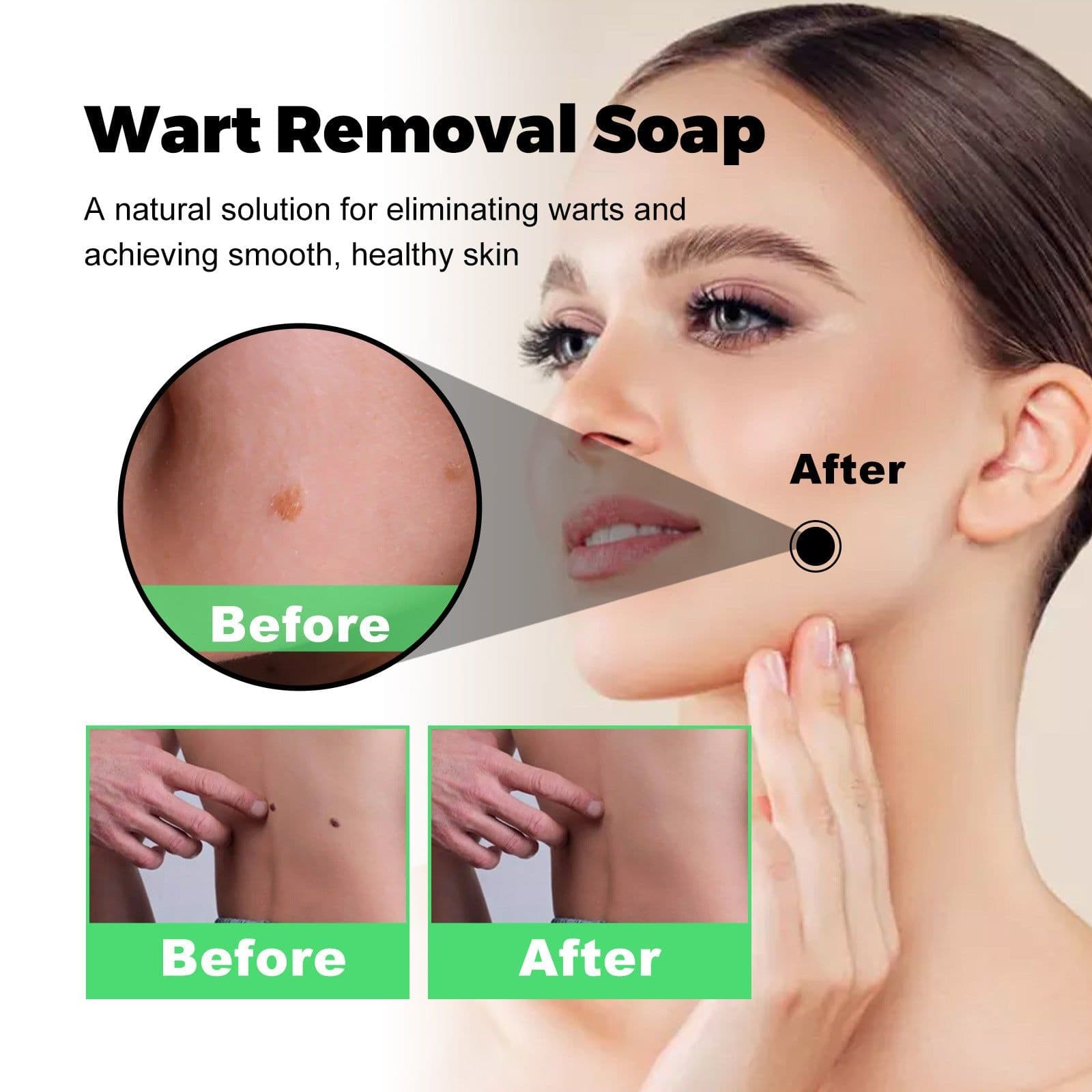 image-South Moon Anti-Wart Soap - Face & Body