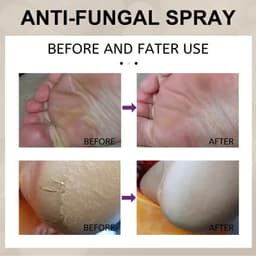 image-Foot Spray - Moisturizing Exfoliating Anti-Itch 30ml