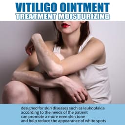 image-South Moon Vitiligo Skin Treatment Ointment 20g