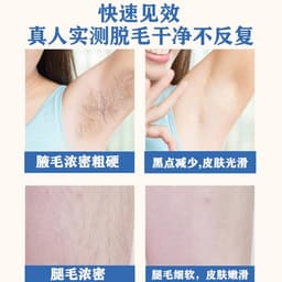 image-IPL Laser Hair Removal Device - Whole Body Painless, Low Price