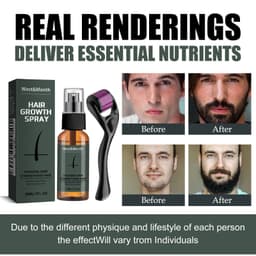 image-West&Month Beard Growth Spray Set 30ml