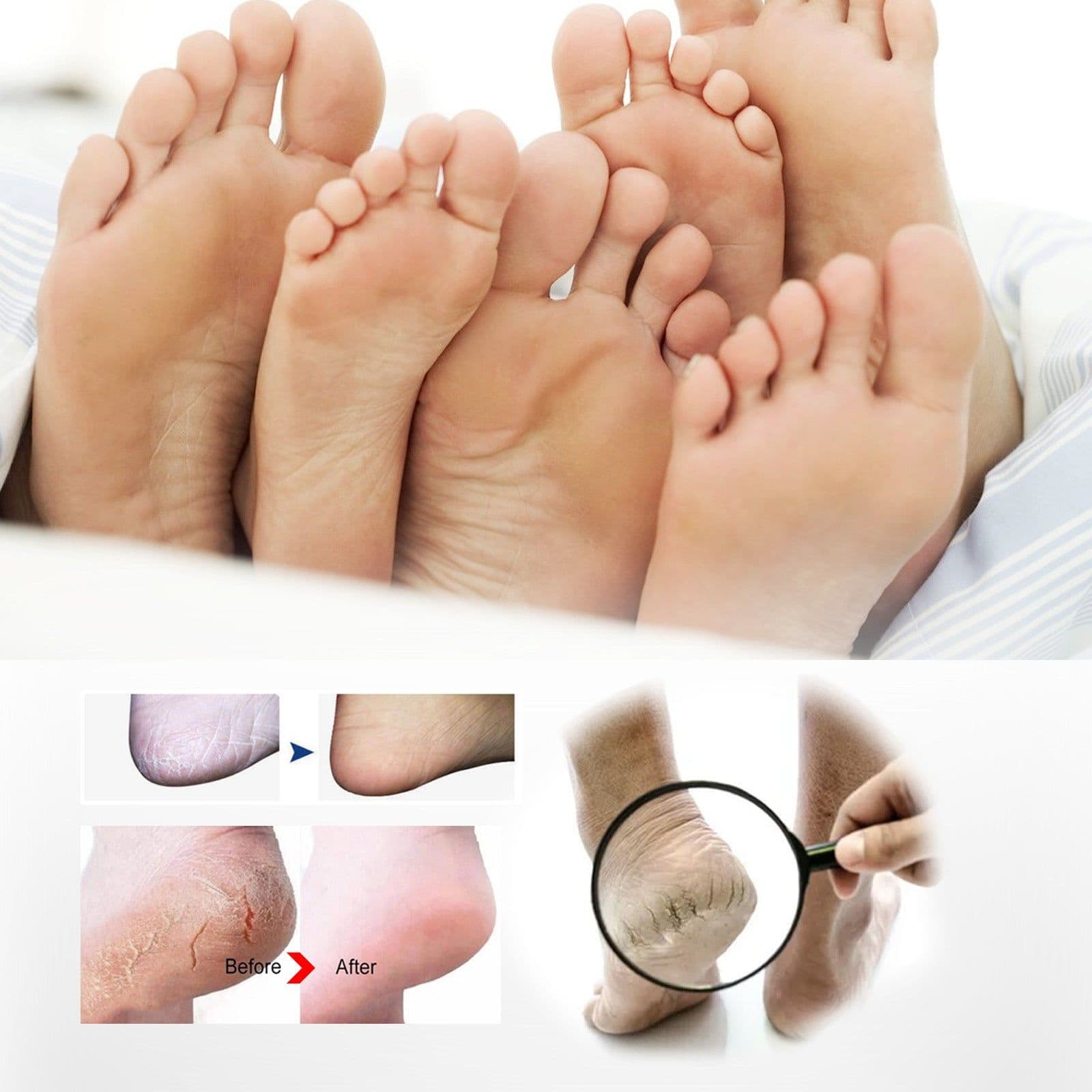 image-Foot Spray - Moisturizing Exfoliating Anti-Itch 30ml