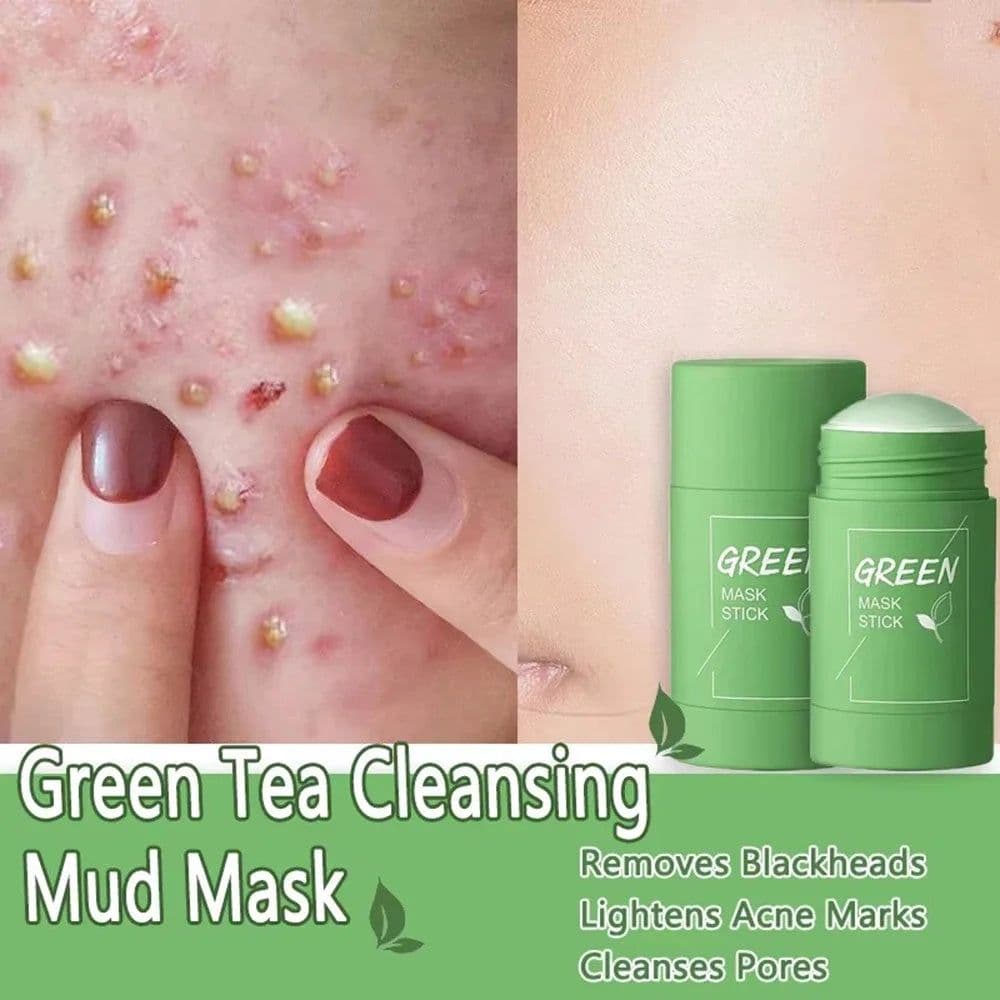 image-Original Facial Remove Blackhead Green Tea Solid Mask Treat Acne Blemish Black Dots Clean Stick Cream Shrink Pores Skin Care
