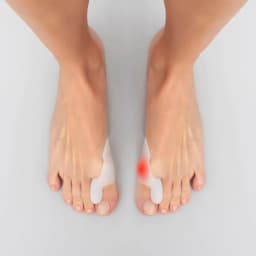 image-Silicone Bunion Corrector Protector Bunilief InnovaGoods 2 Units