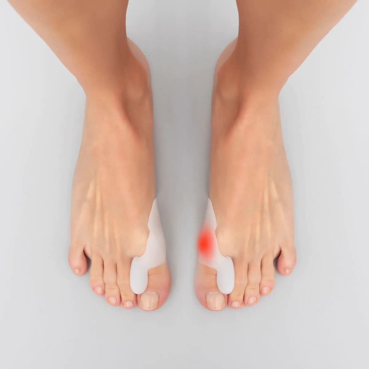 image-Silicone Bunion Corrector Protector Bunilief InnovaGoods 2 Units