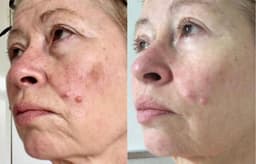 image-Organic Argan Wrinkle Rehab Serum 30ml | collagen-boosting ceramide-rich plant formula